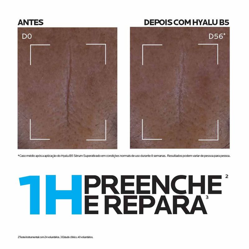 Sérum Facial Antirrugas Superativado La Roche-Posay Hyalu B5 15ml